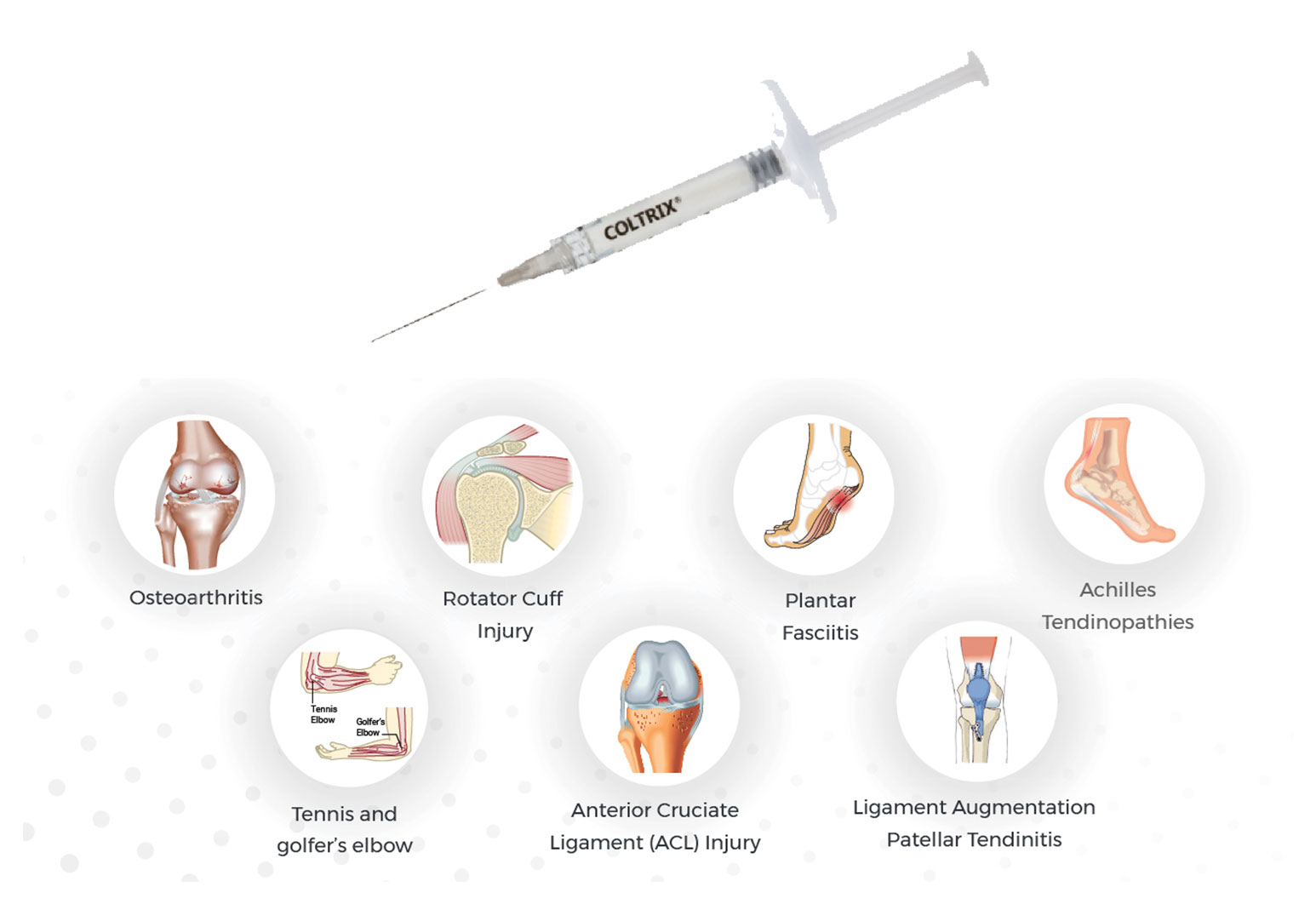 bimendix-coltrix-banner