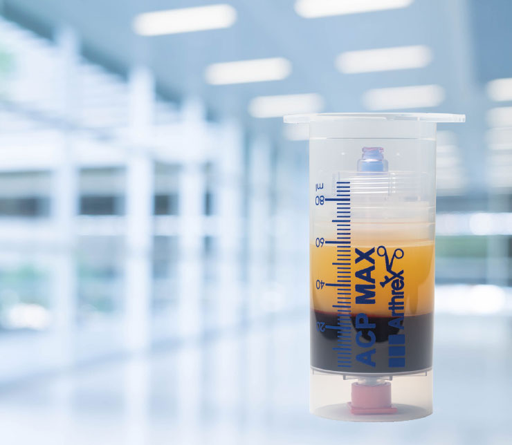 biomendix-acp-max-prp-system