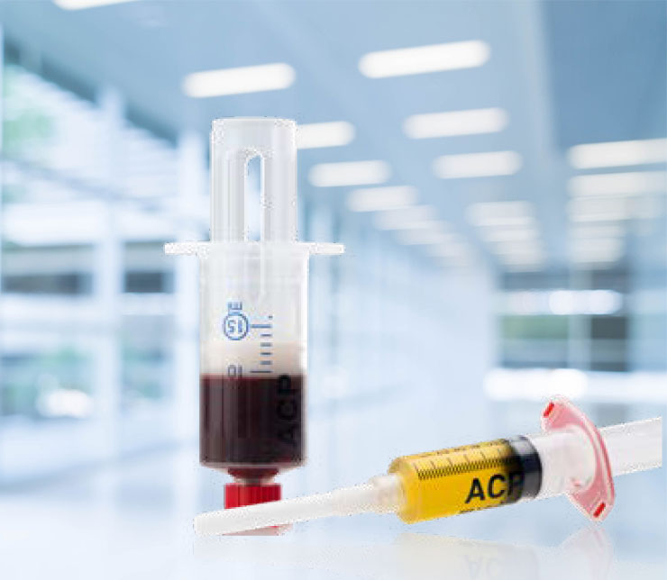 biomendix-arthrex-acp